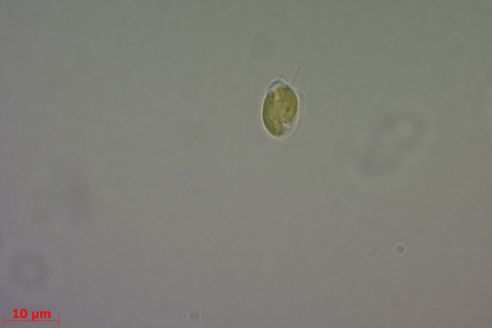 Lichtmikroskopische Aufnahmen einer Zelle von Prymnesium parvum aus den Anreicherungskulturen. Messbalken = 10 µm