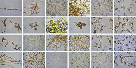 Collage: Mikroskopische Aufnahmen von Phytoplankton und Phytobenthos